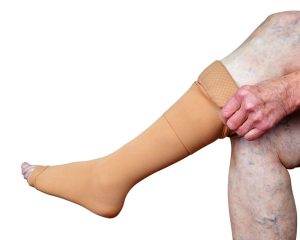  آیا جوراب واریس تاثیر دارد؟ پاسخ علمی و واقعی
